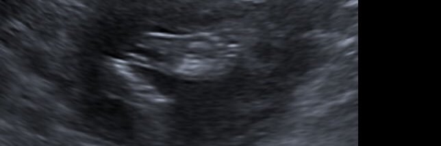 KadyOvern's profile banner image