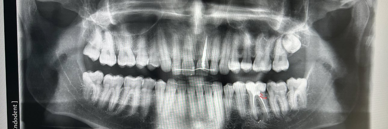 annen.kaynaklari banner