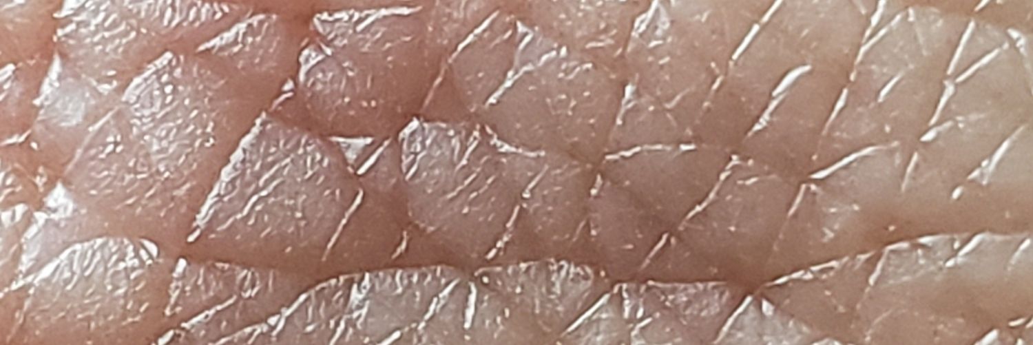 Steve Matthews banner