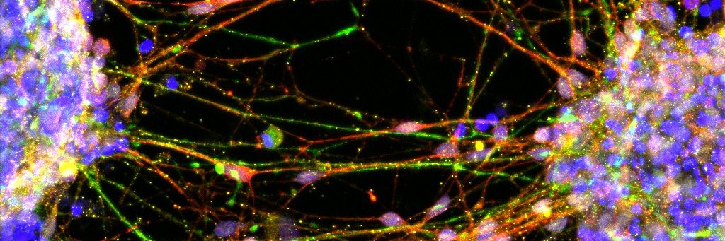 Miranda Lastra Osua banner