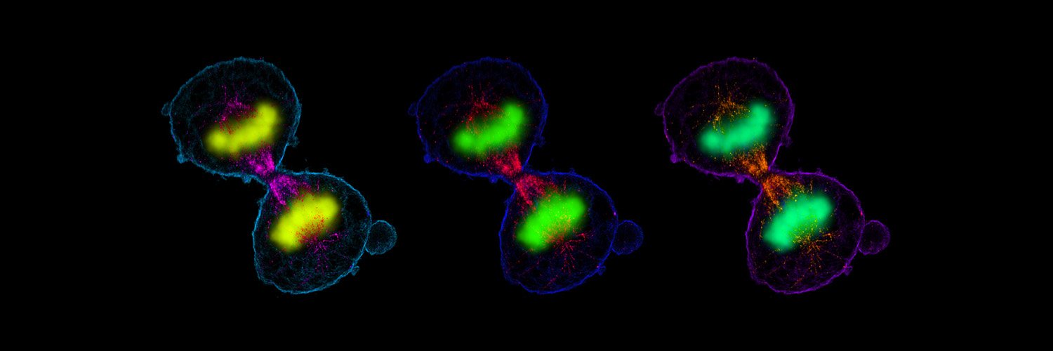 Philipp Hoess banner