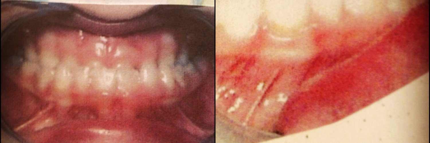 MissingToothYes's profile banner image
