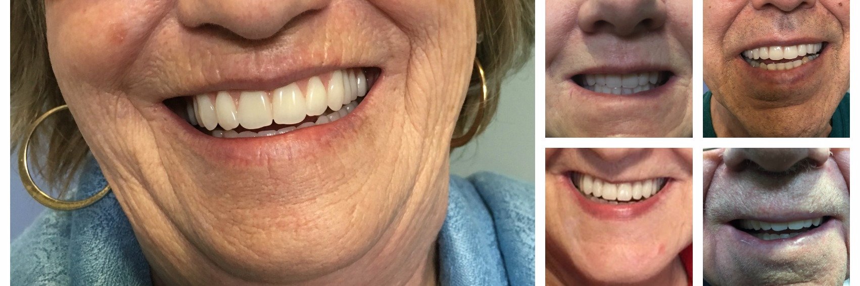 vernondentures's profile banner image