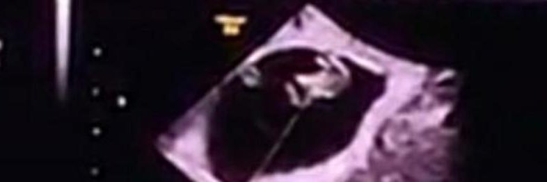 Jose Manuel Saez (Chicha) banner