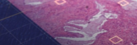 Keen Eye banner