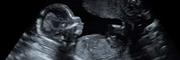 Stacey_Fowler banner