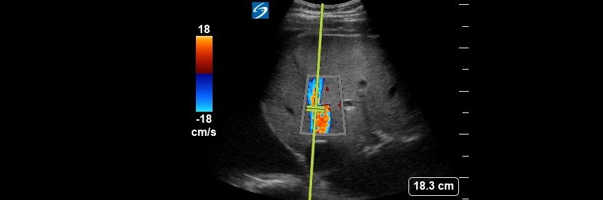 Ahmed T Abdellah banner