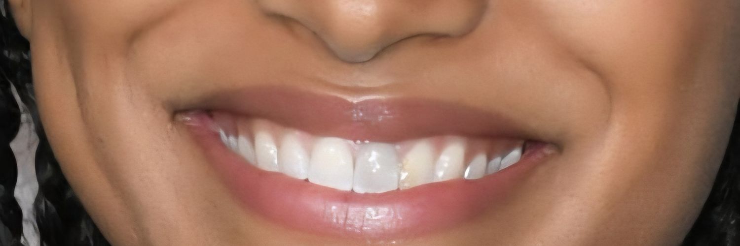Zazie Beetz Dead Tooth banner