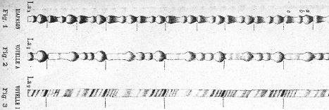 Henri Chamoux banner