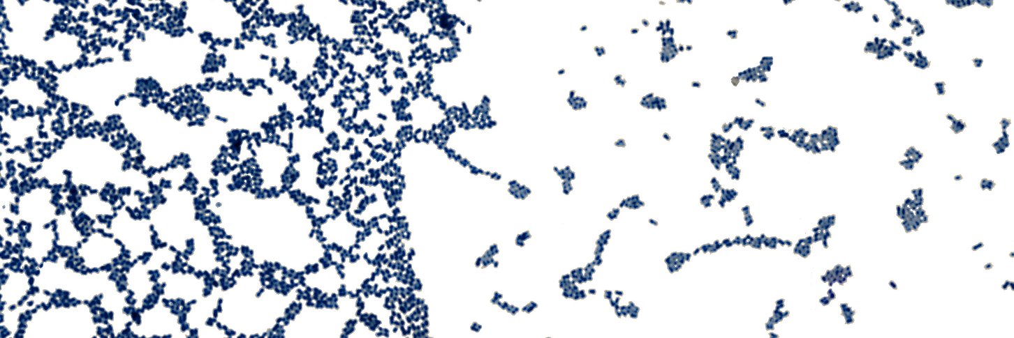 Fluoride Exposed banner