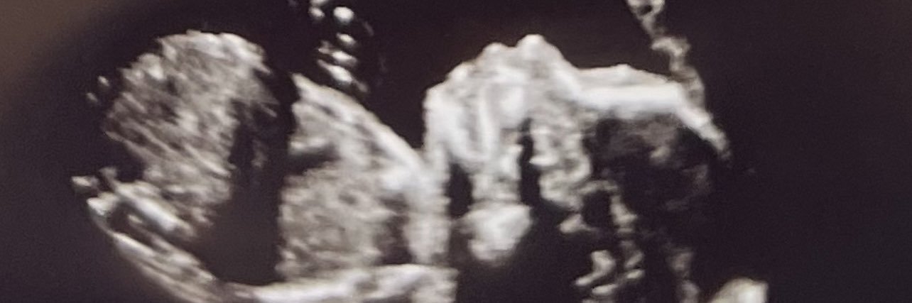 E ♕ banner