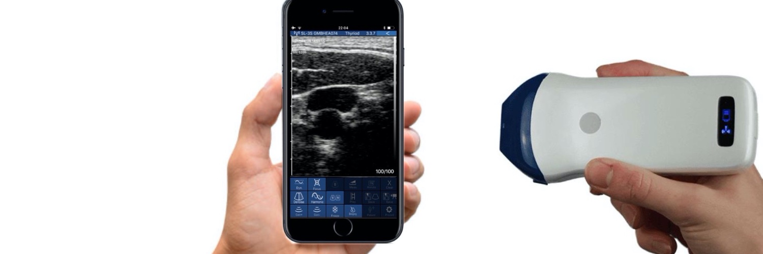 Ballater Medical Wireless Ultrasound banner