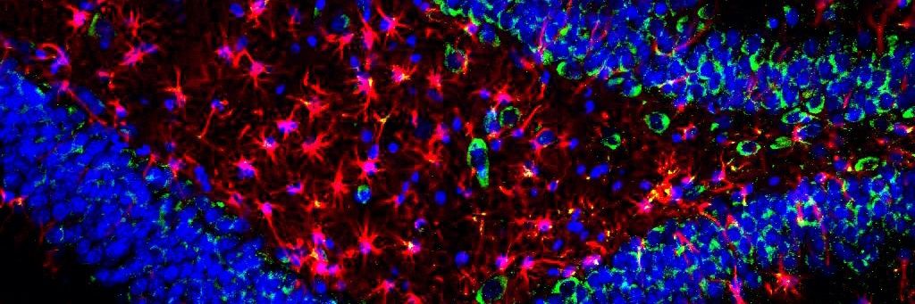 Researching the Brain's banner