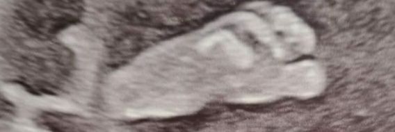Nic Harris banner