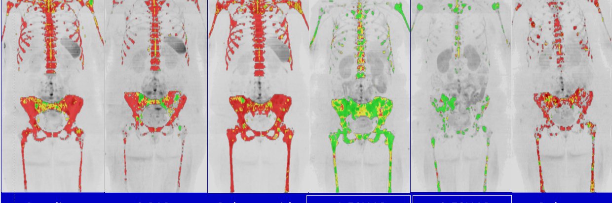 Anwar Padhani banner