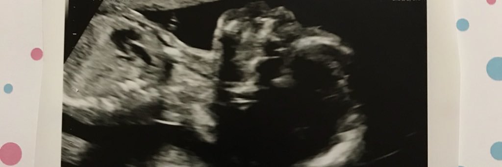 JVernon83's profile banner image