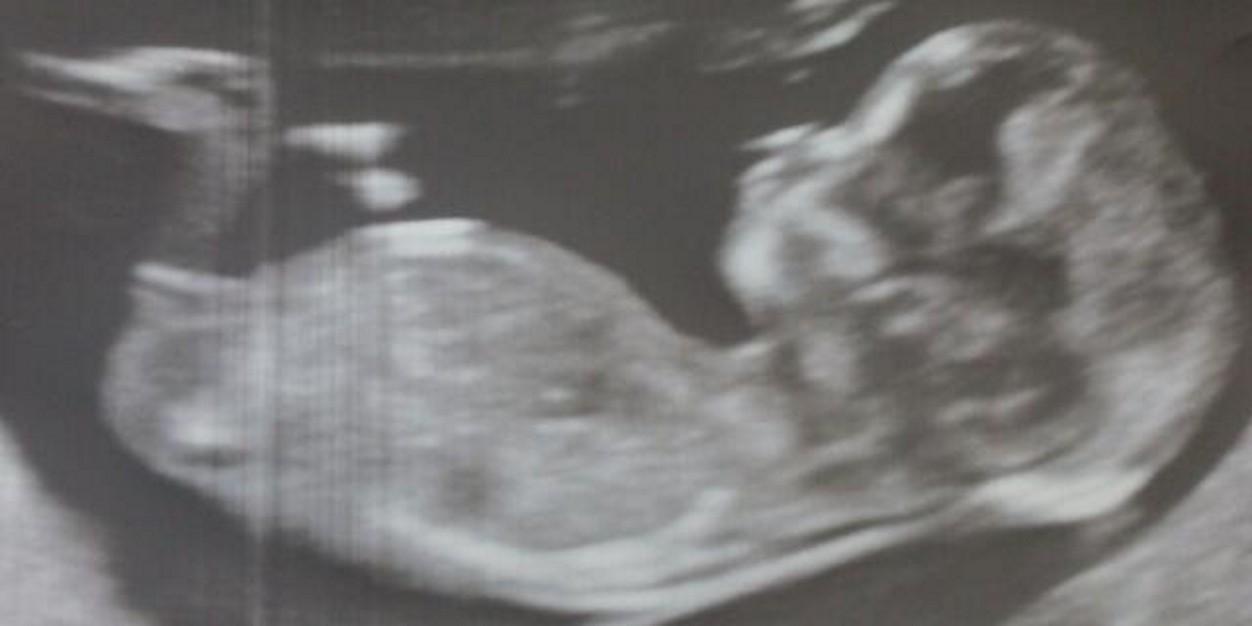 carlos saez perales banner