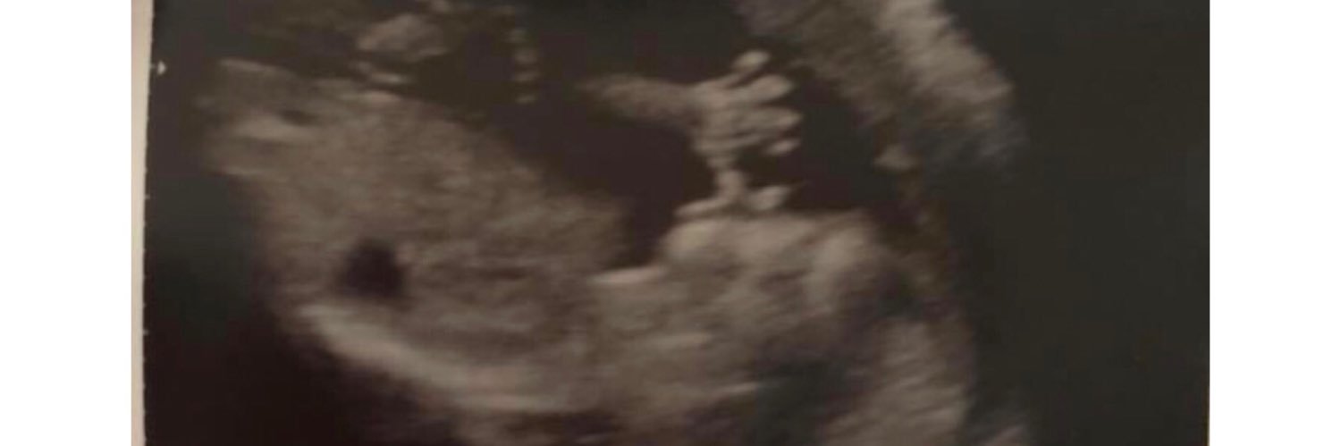 MsCaseyx's profile banner image