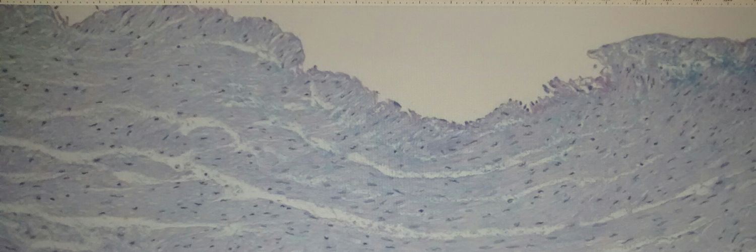 Ryan Dee banner