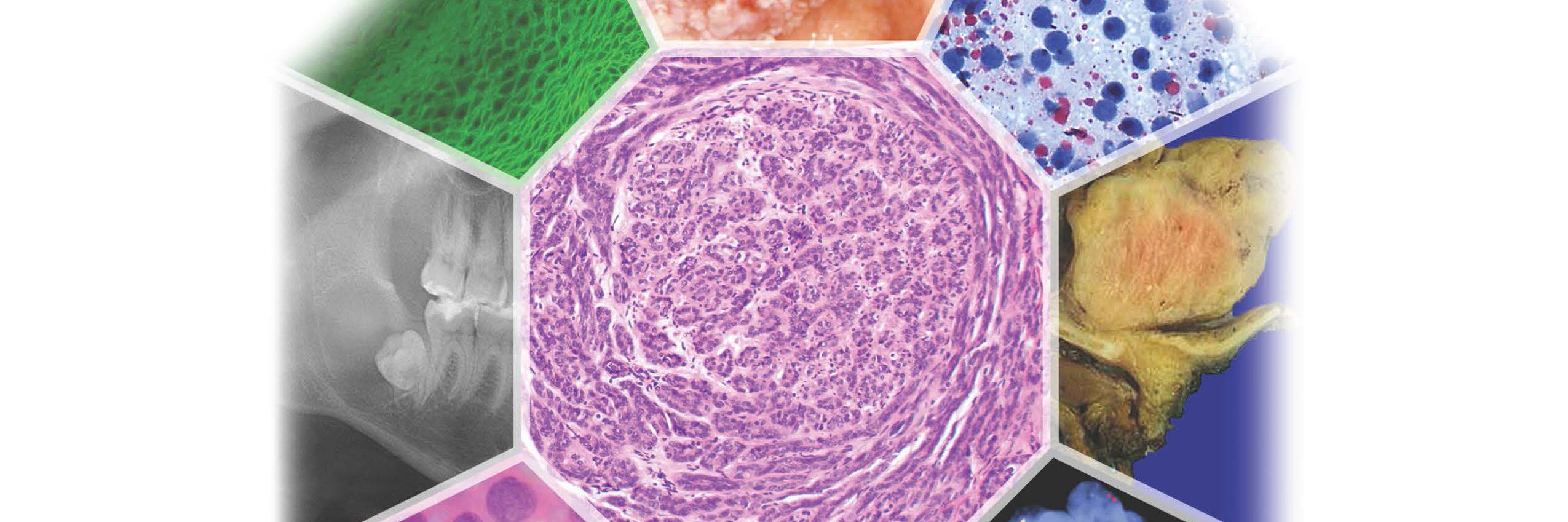 Lester Thompson banner