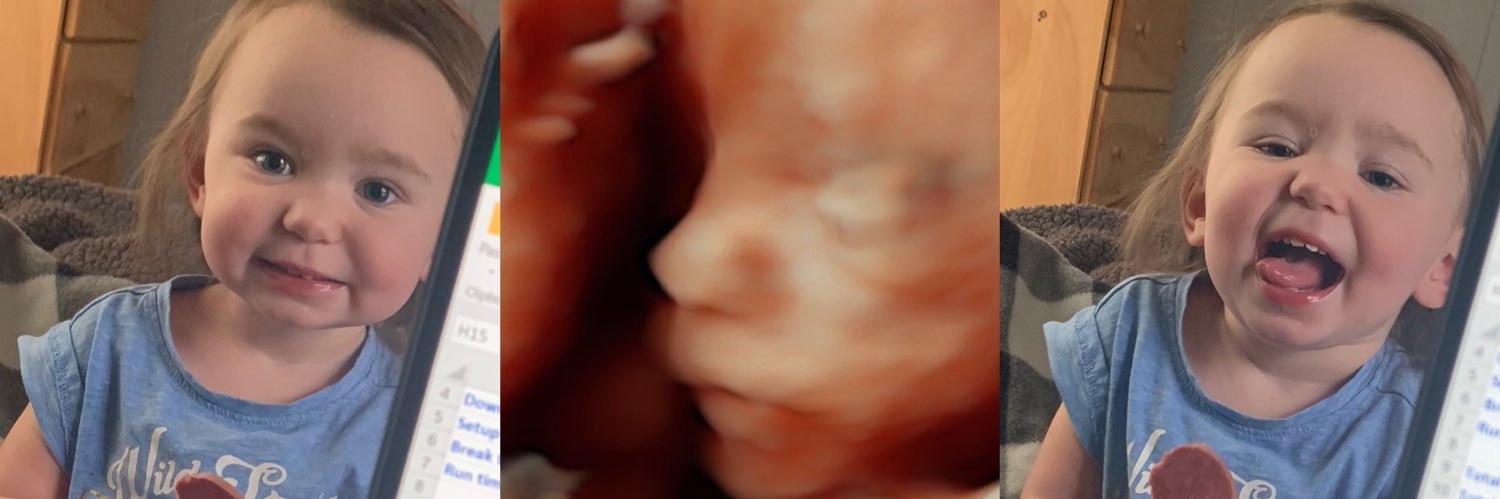 ChelsPollock's profile banner image