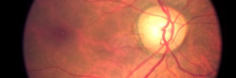 Ehimare Azabs banner