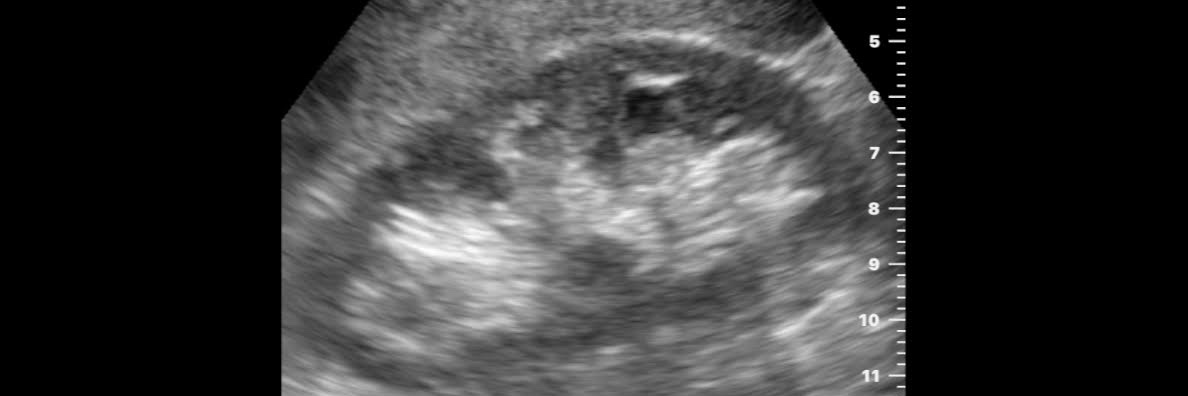 Dan Lasserson banner