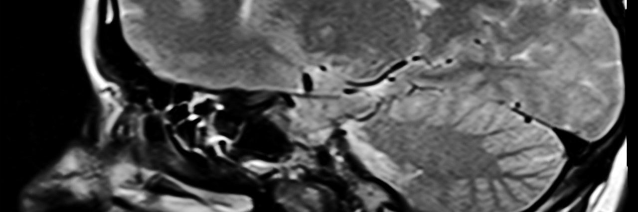 concussionspot's profile banner image