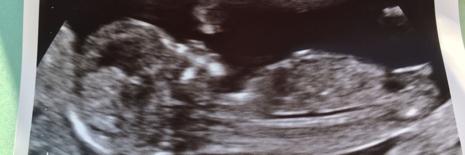 MattBundy13's profile banner image