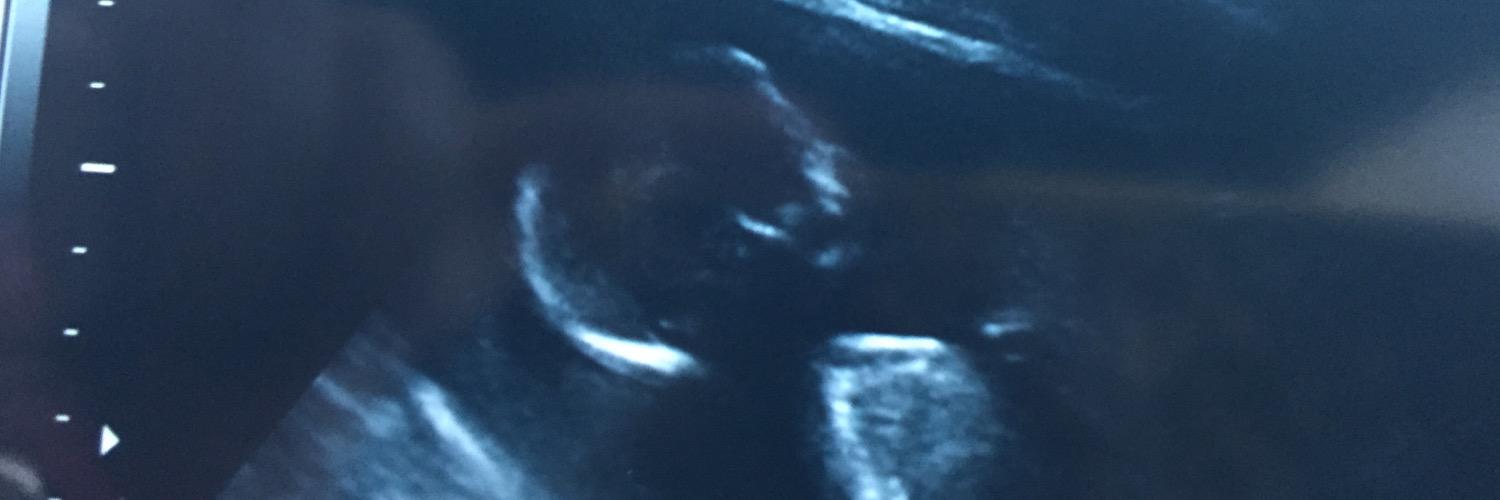 EmileySugden's profile banner image