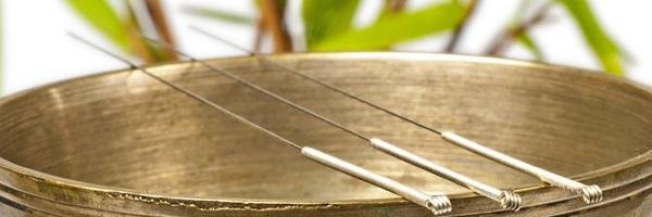 AcupunctureAmanda banner