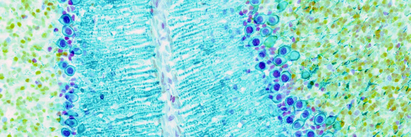 Bonnie Taylor-Blake banner