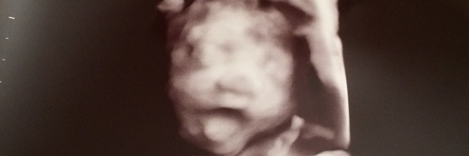 stayblowing's profile banner image