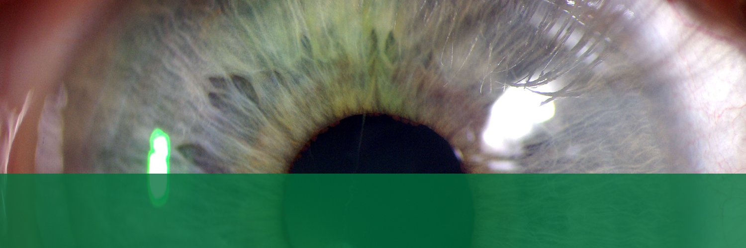JAMA Ophthalmology's banner