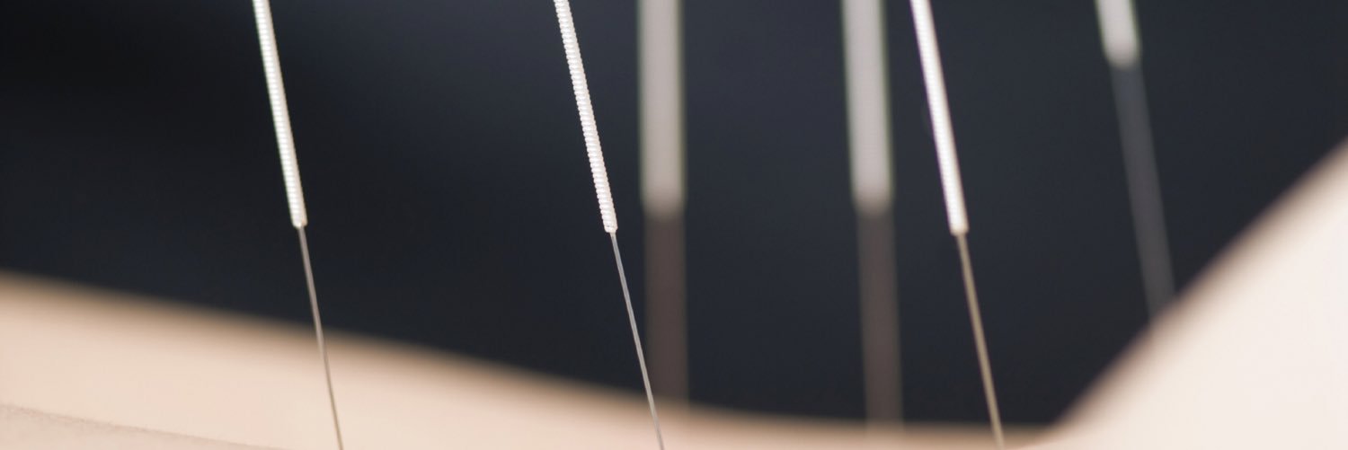 hocacupuncture's profile banner image