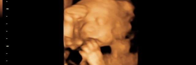 MaKayla2509's profile banner image
