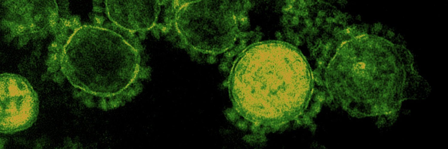 The Pandora Report banner