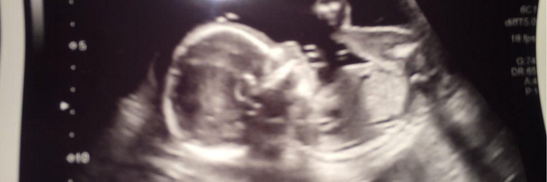 SheldonSwinn's profile banner image