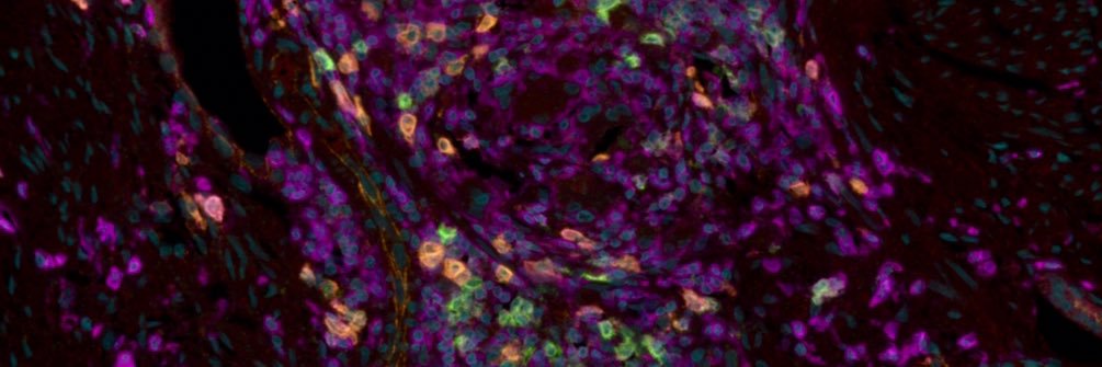 Jessica Duarte banner