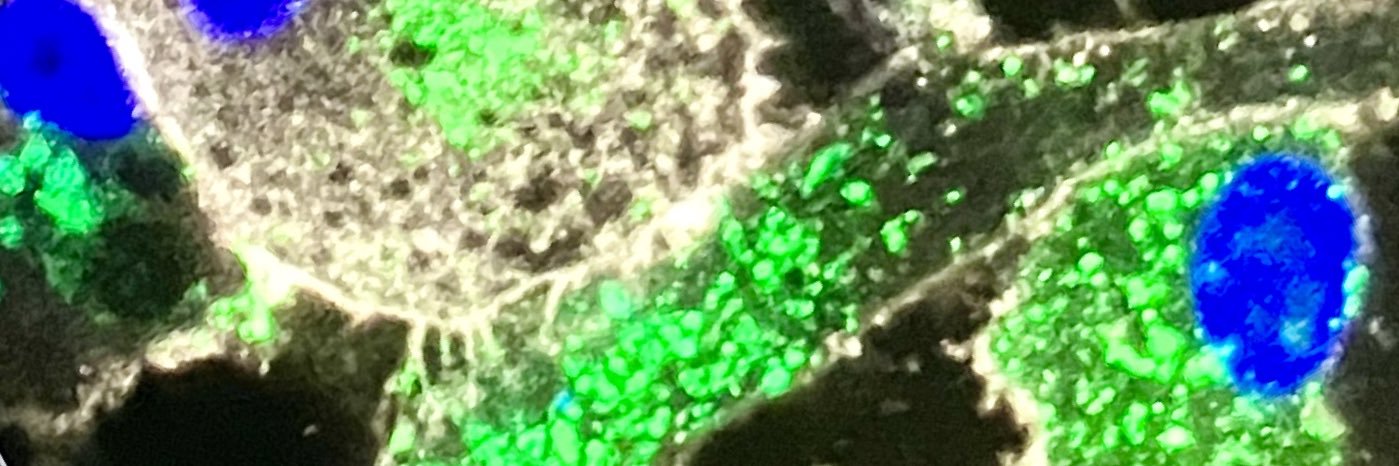Mária Karabová banner