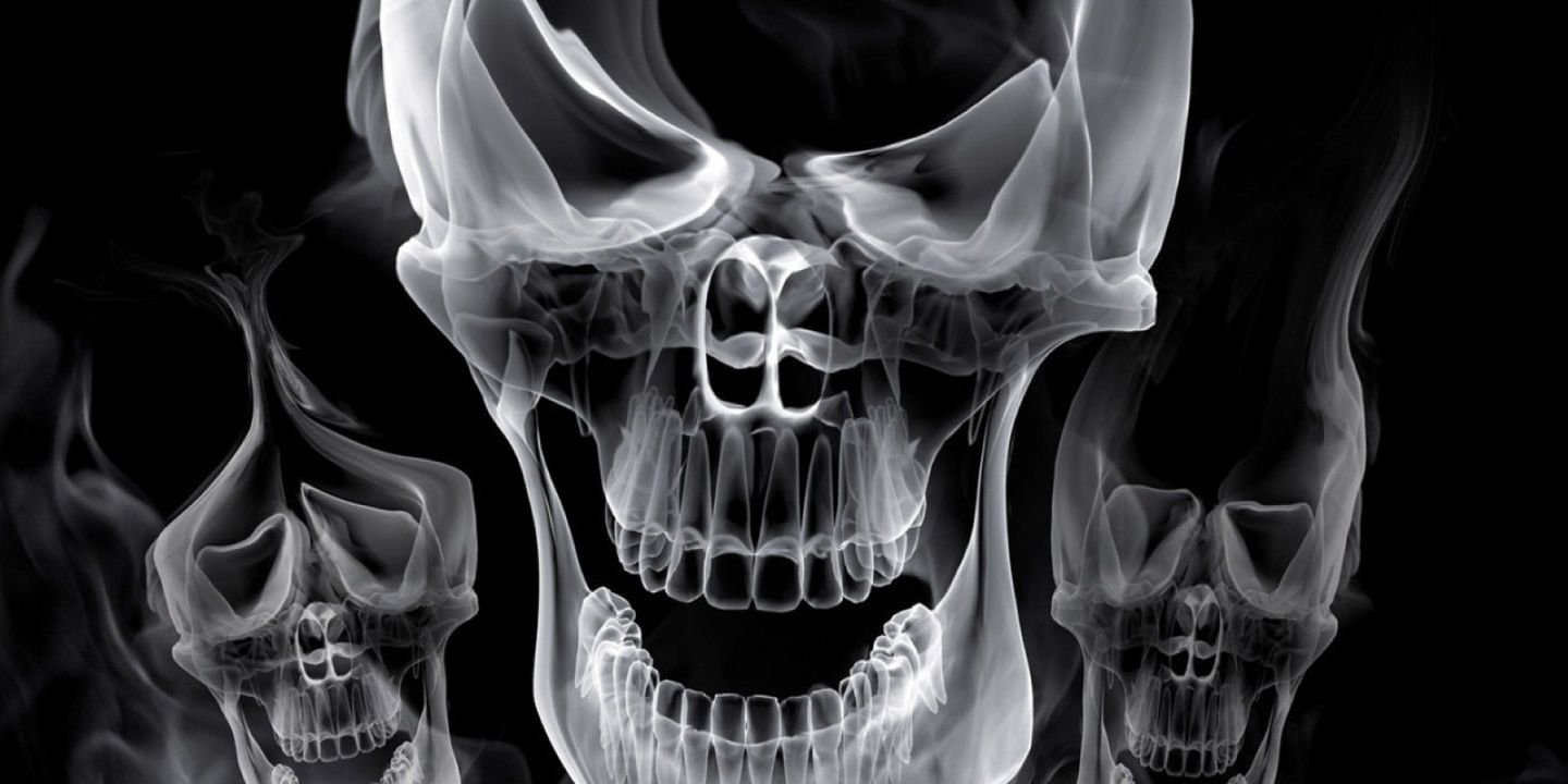 Bobby Dazzler banner