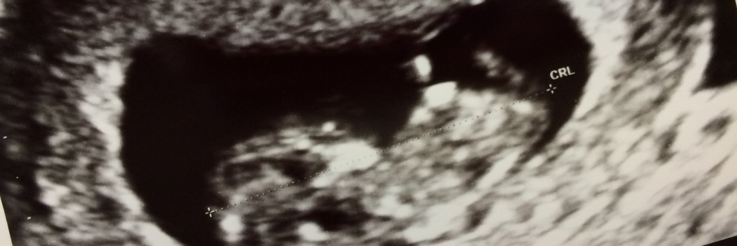 Jacolbi21's profile banner image