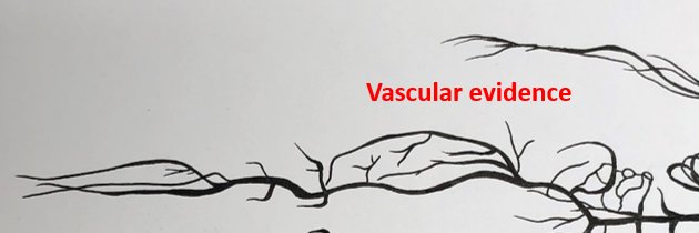 Vasc_Evidence's profile banner image