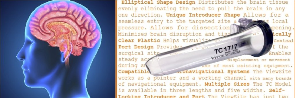 vycormedical's profile banner image