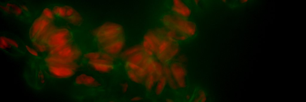 Karen Grace Bondoc-Naumovitz banner