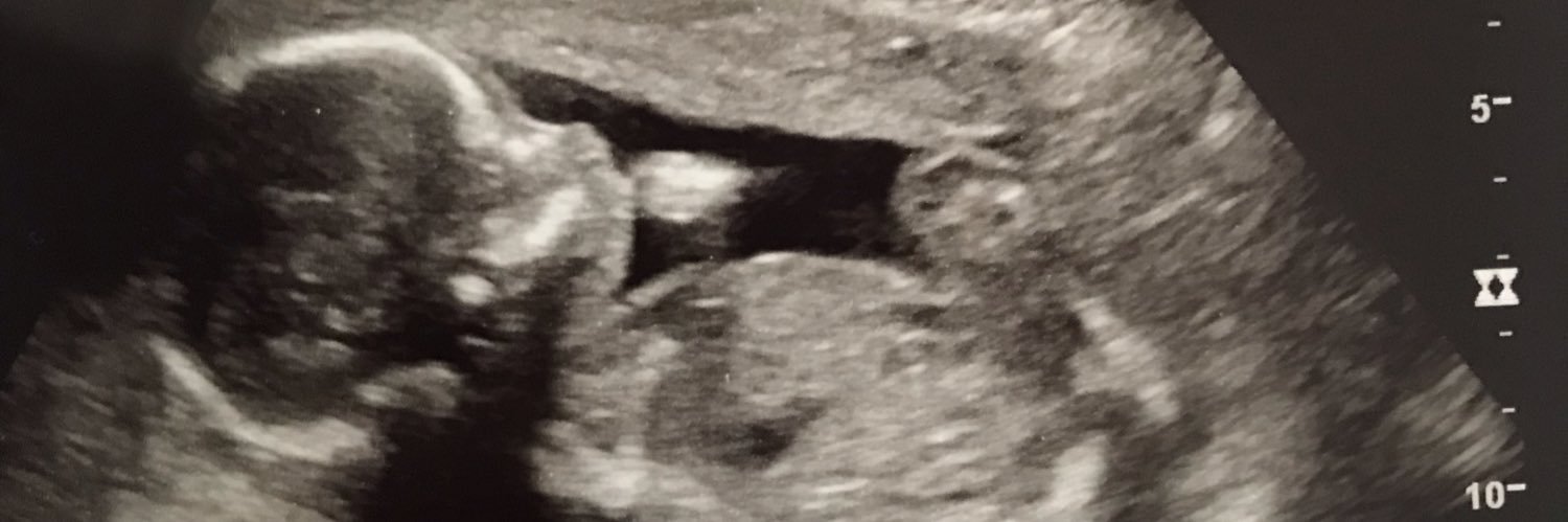 Karly_Harrison's profile banner image
