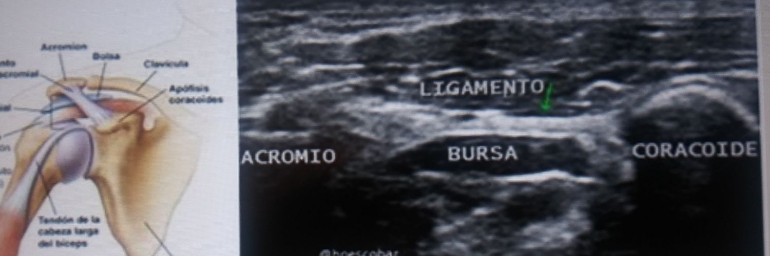 Hernán Escobar banner