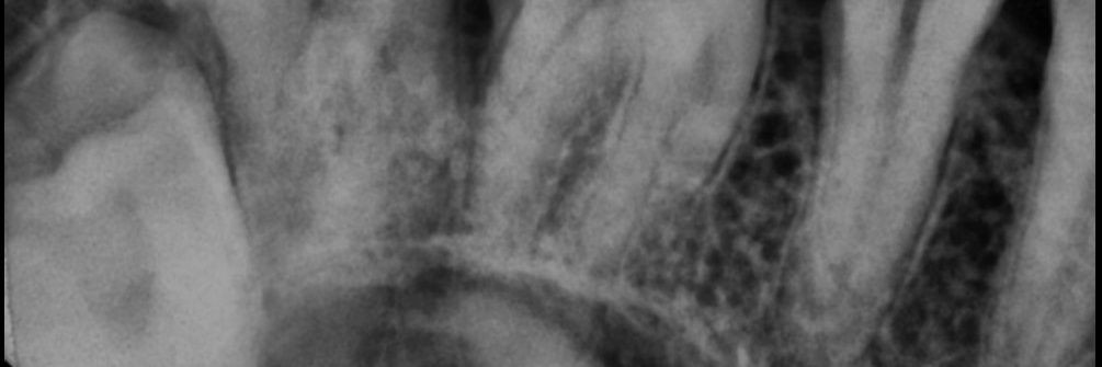hafte3000 banner