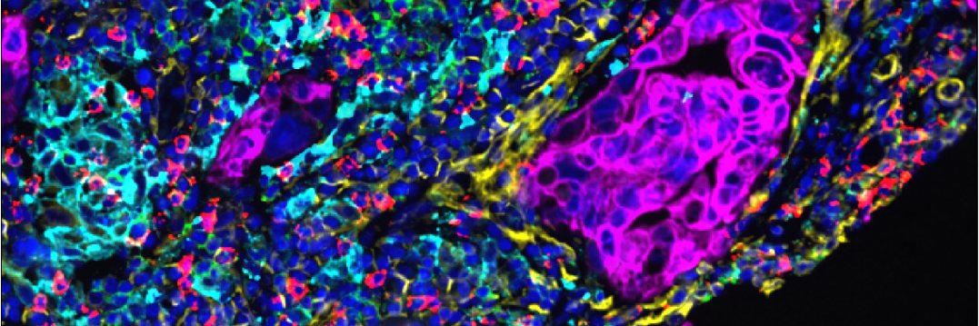 Fernando Perez-Villatoro banner