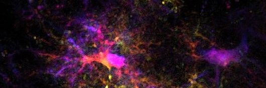 Anthony Bosson banner